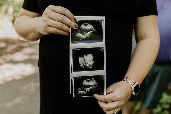Laura-Travis-Maternity-1112