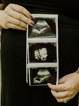 Laura-Travis-Maternity-1113