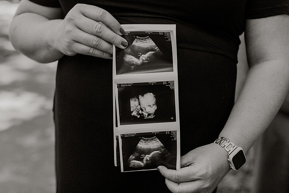 Laura-Travis-Maternity-1114